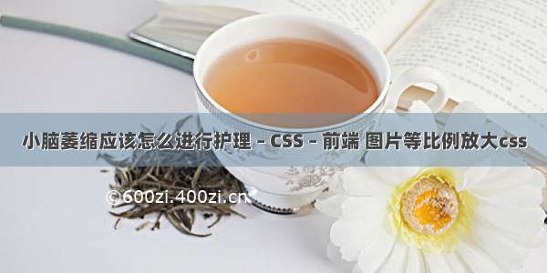 小脑萎缩应该怎么进行护理 – CSS – 前端 图片等比例放大css