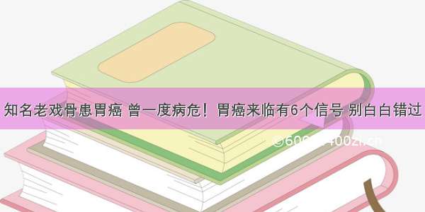 知名老戏骨患胃癌 曾一度病危！胃癌来临有6个信号 别白白错过