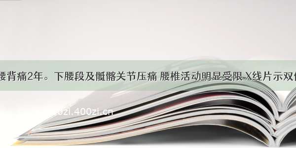 男 22岁。腰背痛2年。下腰段及骶髂关节压痛 腰椎活动明显受限 X线片示双侧骶髂关节