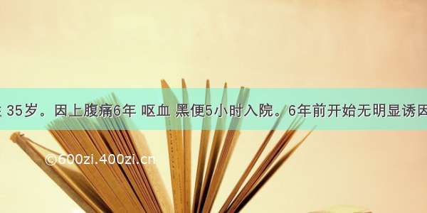 患者 男性 35岁。因上腹痛6年 呕血 黑便5小时入院。6年前开始无明显诱因间断性上