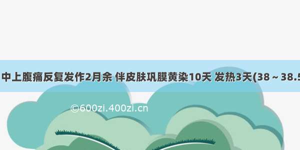 女性 52岁 中上腹痛反复发作2月余 伴皮肤巩膜黄染10天 发热3天(38～38.5℃)。体格